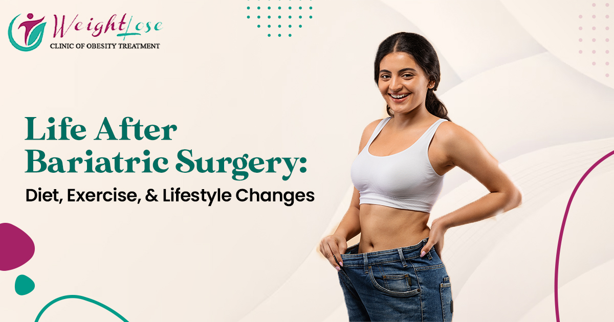 Life After Bariatric Surgery: Diet, Exercise, and Lifestyle Changes